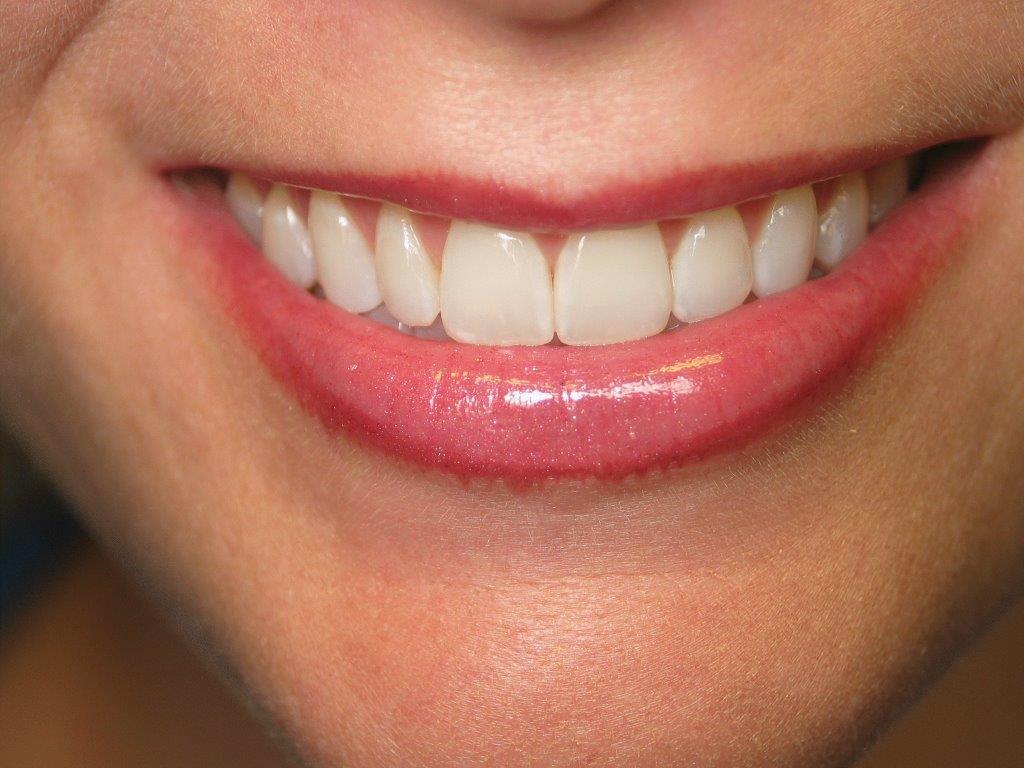 White Teeth | Jonesboro AR Teeth Whitening