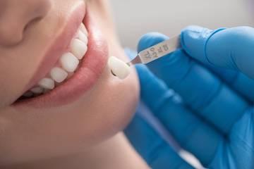 Woman getting Veneers | Dentist Jonesboro