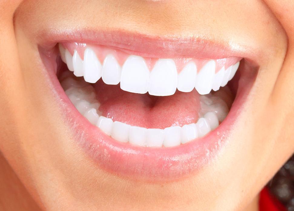 Bright Smile | Teeth Whitening Jonesboro AR