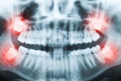 dental x-rays jonesboro AR