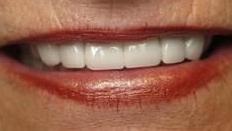 Cosmetic Dentist Photo | Jonesboro AR Dentist