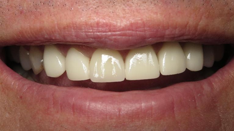 Smile | Dentist in Jonesboro AR