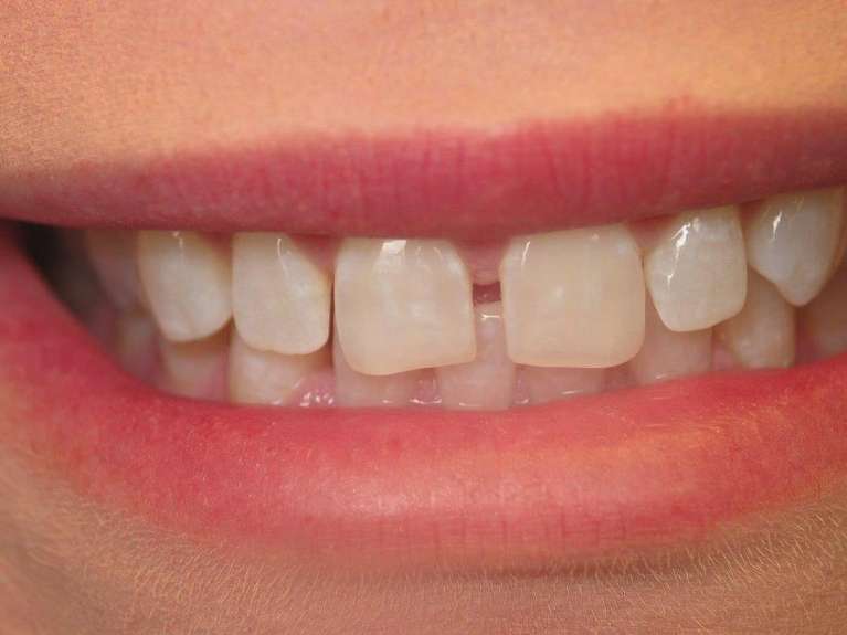 Cosmetic-Dentistry-Before-Image