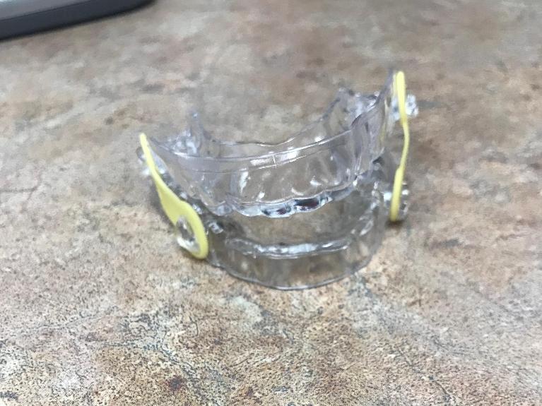 custom snoring appliance in jonesboro ar