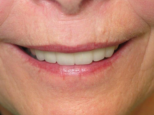 Anthony Bartels DDS After 1