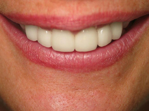 Anthony Bartels DDS After 2
