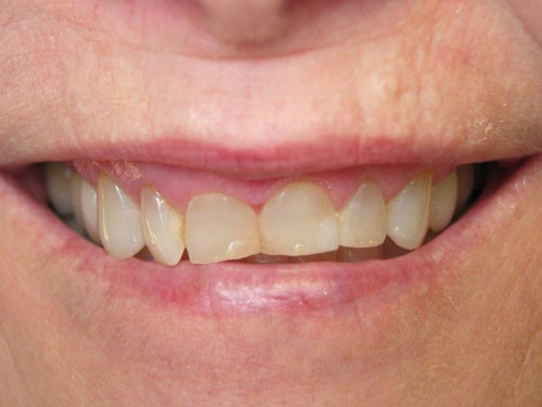 Anthony Bartels DDS Before 1