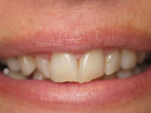 Anthony Bartels DDS Before 2